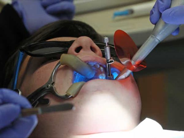 Procedures for Maintaining Dental Health